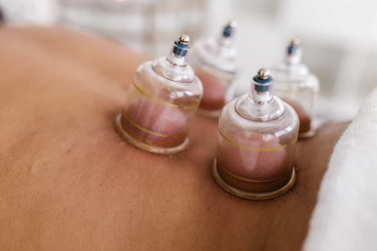 Hijama Estetica Cosmetics